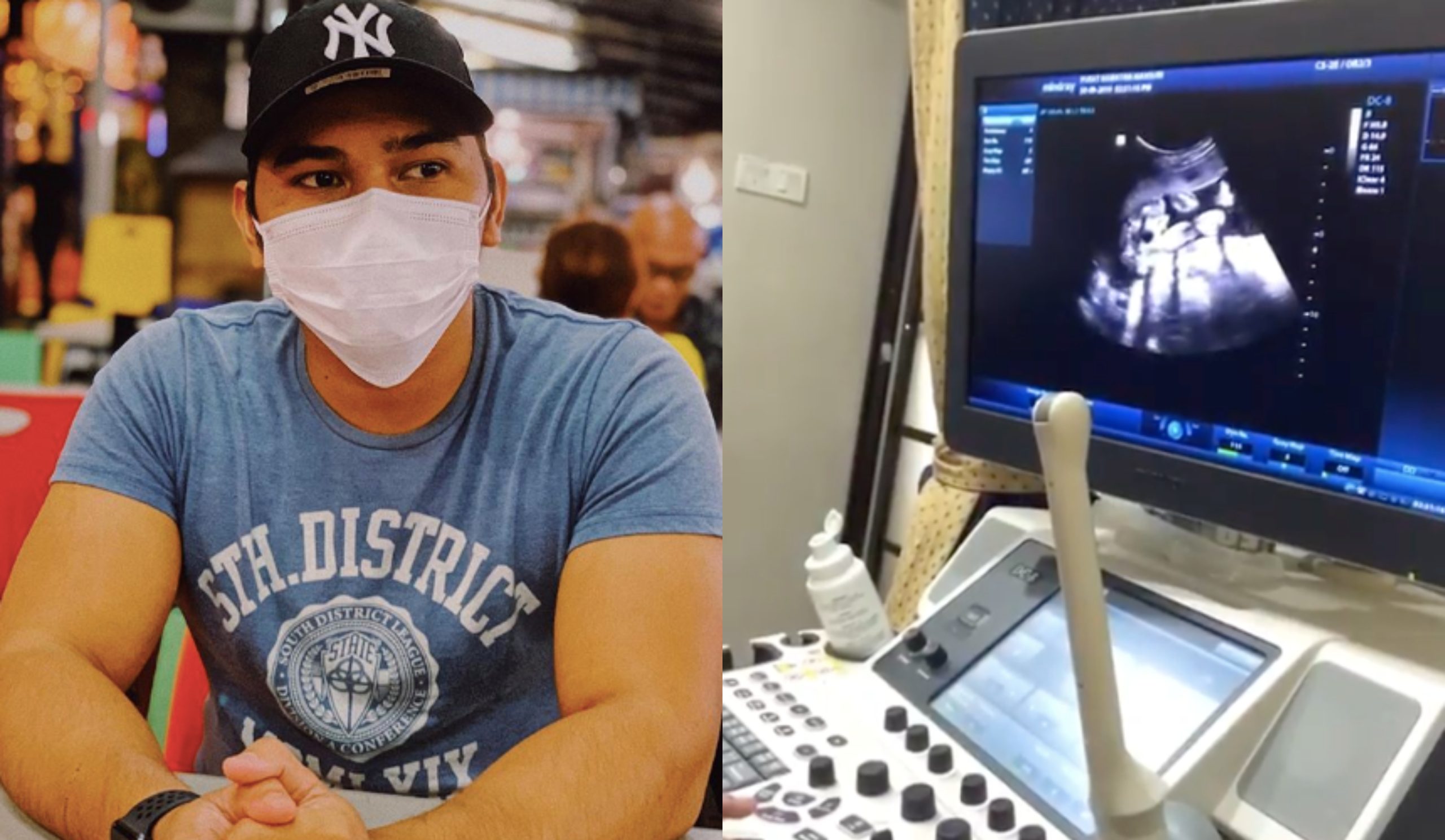 Kongsi Ultrasound Anak Dengan Isteri Baru, PU Abu Sekali Lagi Dikritik