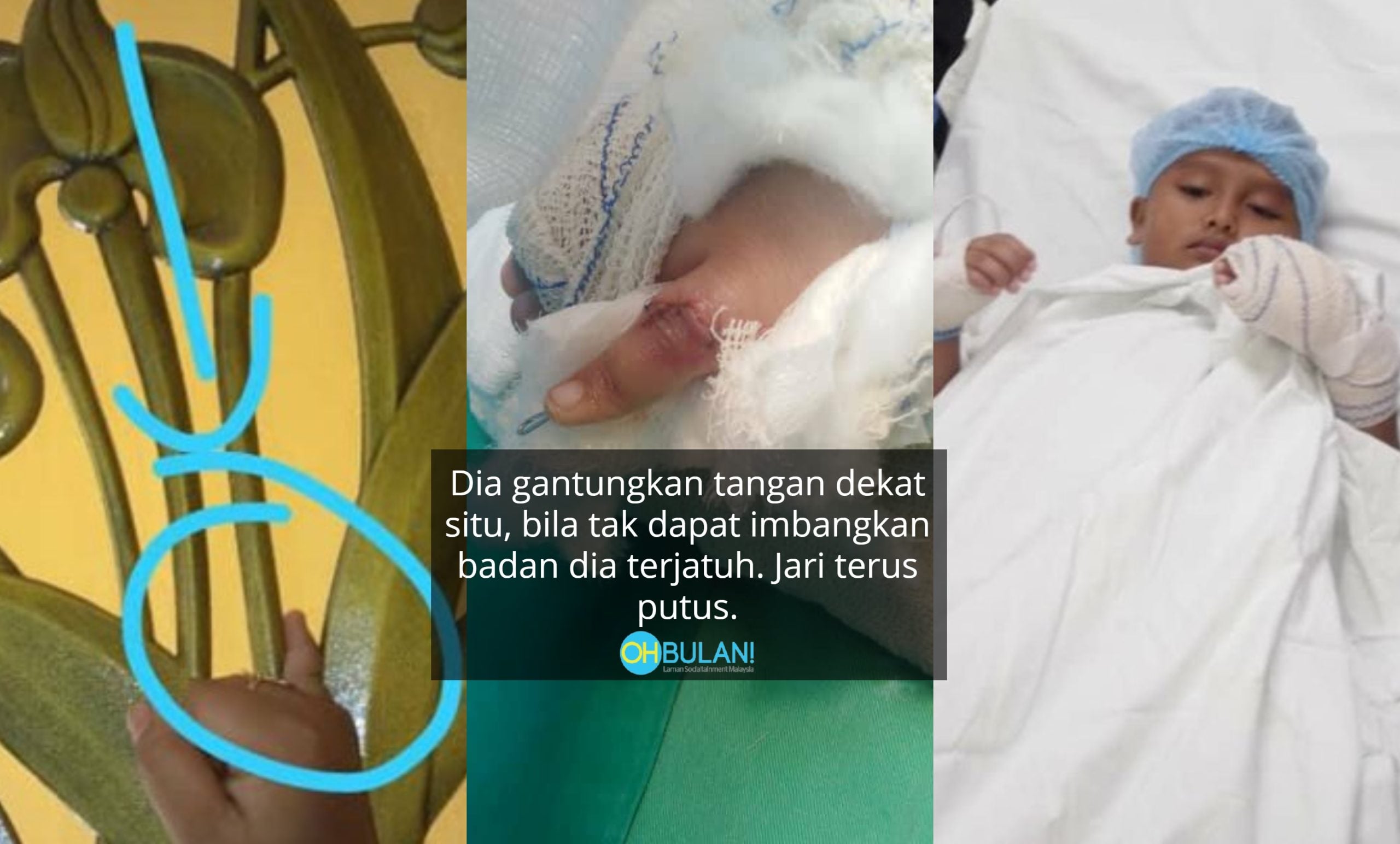 Jari Kanak-Kanak Ini Terputus Gara-Gara Bermain Di Grill Rumah