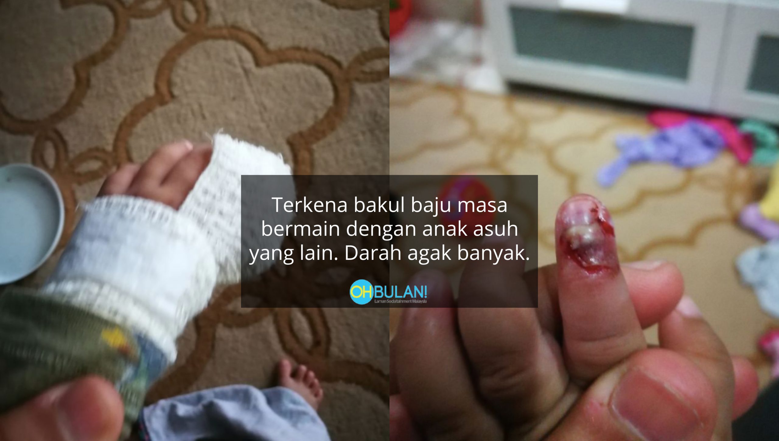 ‘Bila Dah Dicabut.. Aduhai Luka Teruk Rupanya’