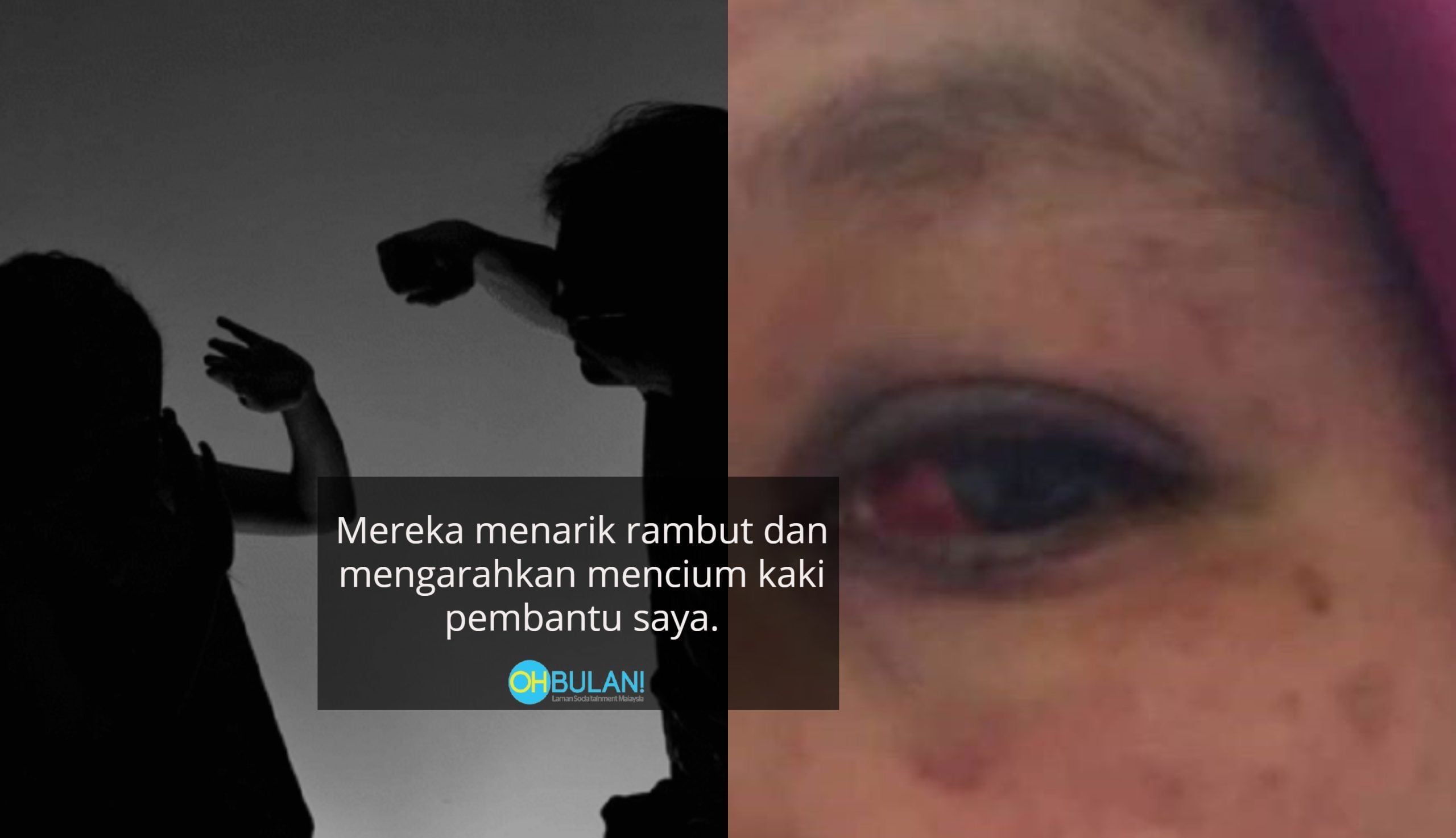 ‘Dipukul Guna Objek Keras, Mata Dicili’ -Guru Dakwa Diserang Pembantu Tabika Ketika Mahu Mengajar