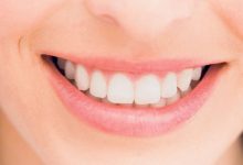 Rawatan Scalling Tidak Memutihkan Gigi, Ikuti Perkongsian Doktor Ini Untuk Gigi Seputih Berlian