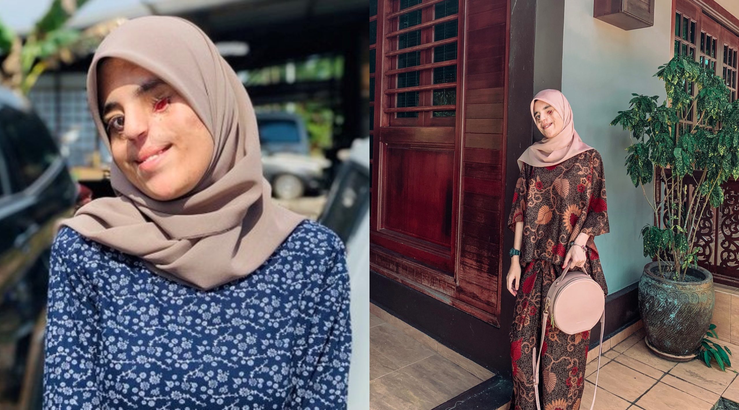 ‘Okay Je Lahir Berbeza, Kan?’ – Respon Neelofa Kepada Foto Gadis Ini Undang Pujian