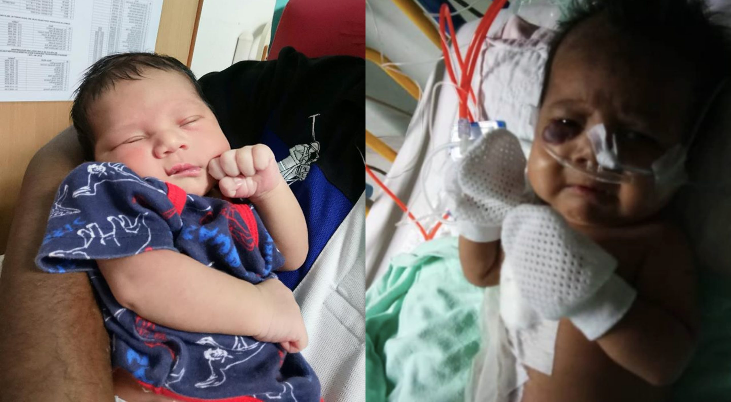 Usia Baru 2 Bulan Dah Jalani 2 Pembedahan, Bapa Kongsi Derita Anak Dijangkiti Kuman & Masalah Usus