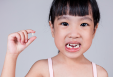 Gigi Terpatah Jangan Dibuang, Ini Langkah Awal Untuk Elak Anak Rongak