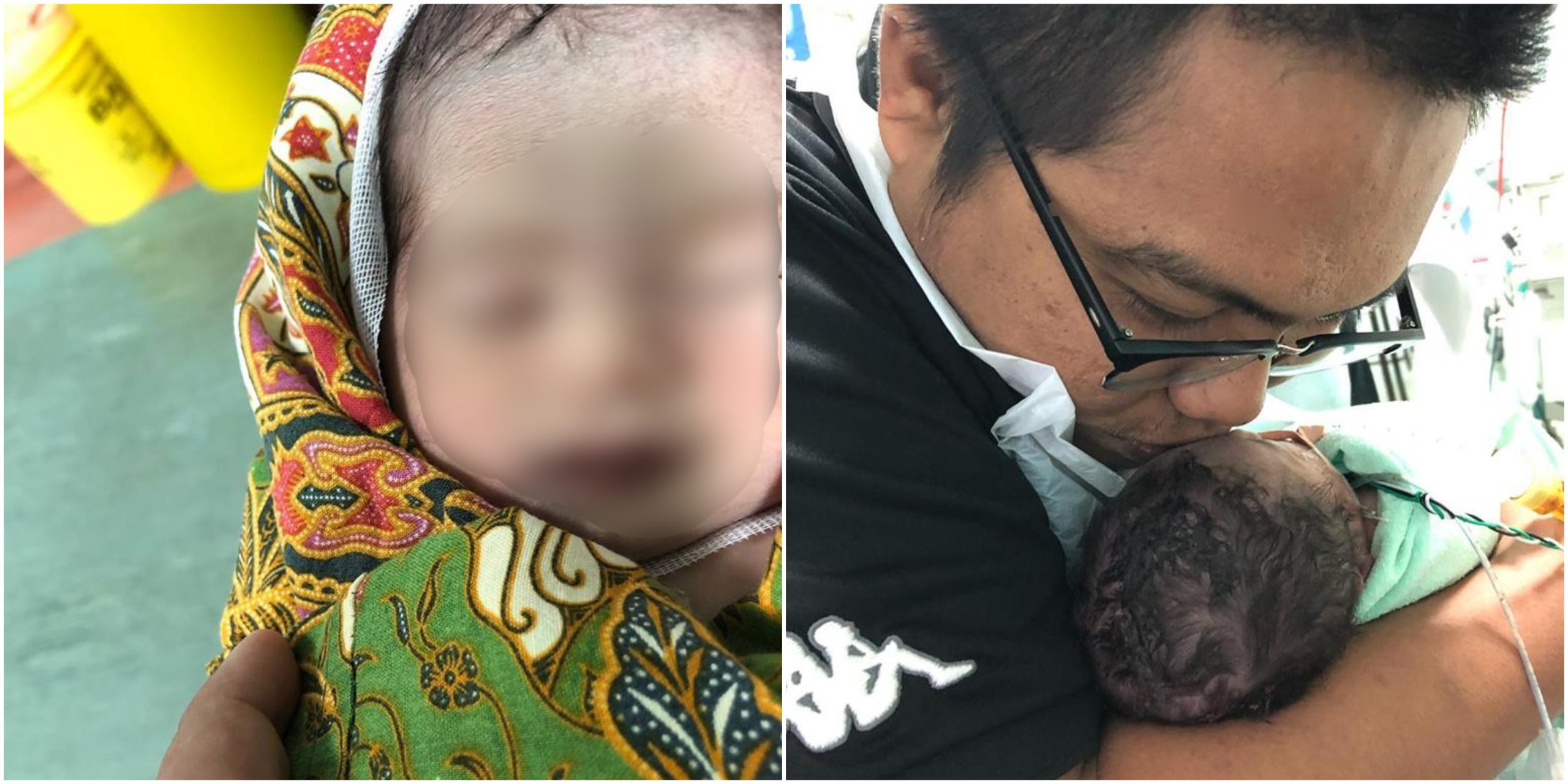 ‘Lahir Tanpa Kidney, Limpa & Salur Najis’ – Ibu Redha Dengan Pemergian Anak