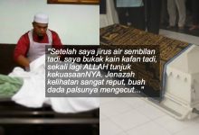 Badannya Bertukar Kehitaman, Bernanah – Lelaki Ini Kongsi Pengalaman Mendebarkan Urus Jenazah Tukar Jantina