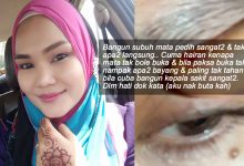 Nyaris Buta Secara Tiba-Tiba, Wanita Ini Kongsi Kesan Jangka Masa Panjang Contact Lens