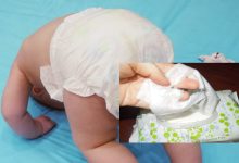 Wet Tissue Punca Jangkitan Kencing Kotor, Buah Pinggang Bayi Rosak? Ini Penjelasan Pakar Perubatan