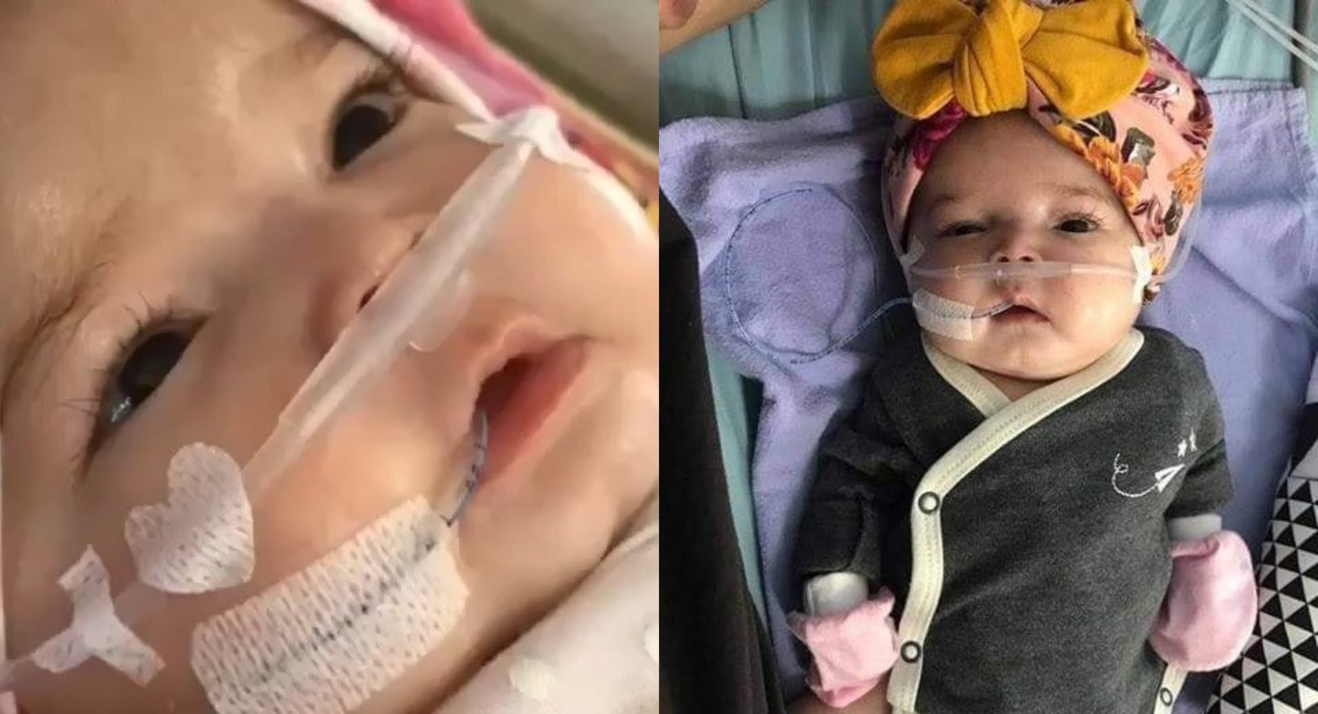 ‘Semoga Dia Kembali Sihat’ – Bayi 4 Bulan Derita Kanser Otak & Buah Pinggang