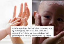 Risau Bayi 33 Hari Makin Gelap, Lihat Cadangan Ibu Ini Kembali Putihkan Anak. Win Habis!