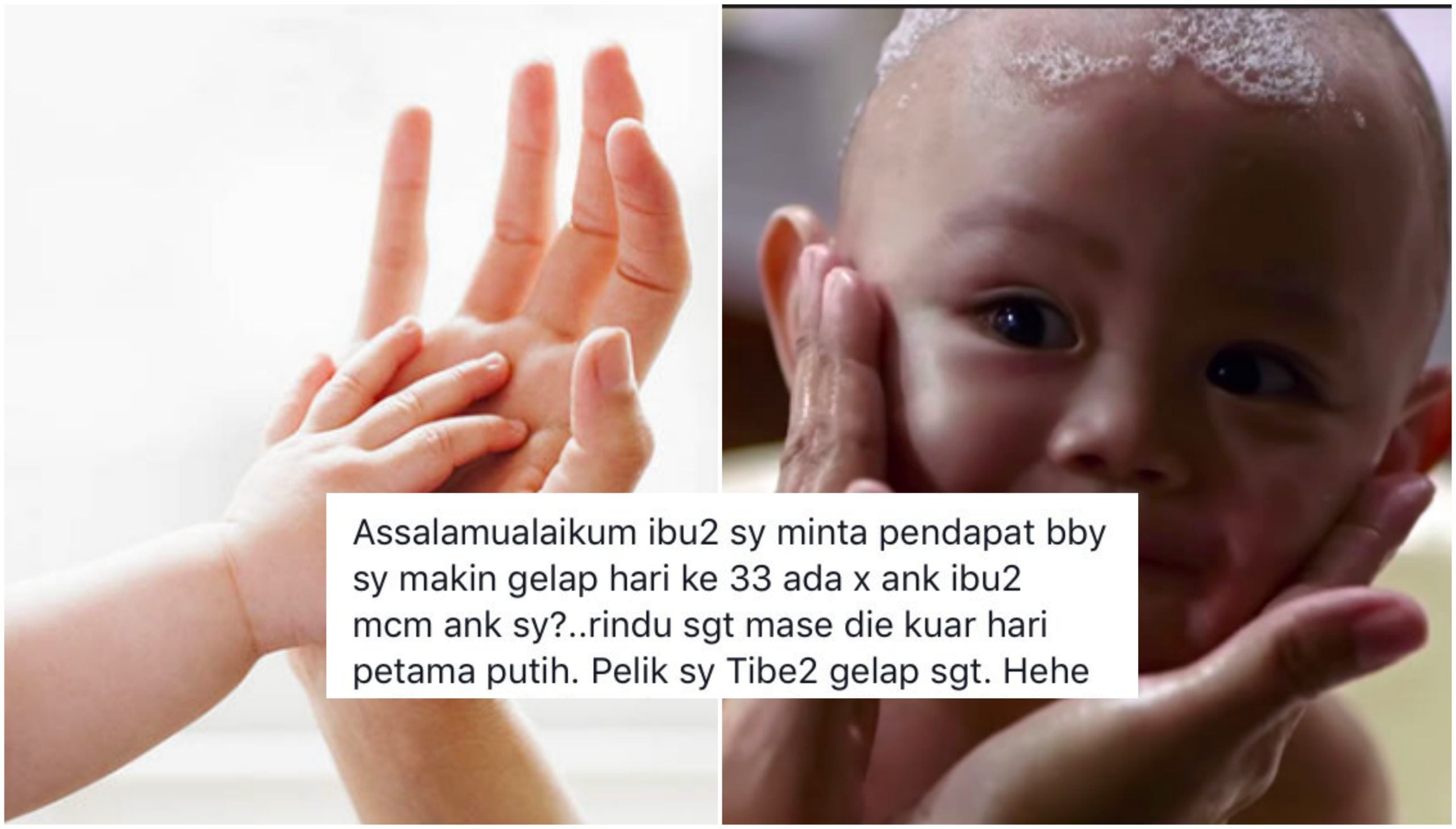 Risau Bayi 33 Hari Makin Gelap, Lihat Cadangan Ibu Ini Kembali Putihkan Anak. Win Habis!