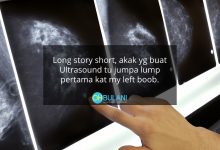 Ada 3 Ketulan Kecil Di Payudara, Wanita Kongsi Pengalaman Mendebarkan Jalani Ujian Ultrasound