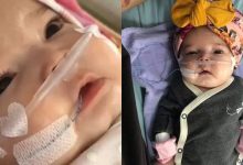 ‘Semoga Dia Kembali Sihat’ – Bayi 4 Bulan Derita Kanser Otak & Buah Pinggang