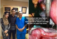 Hidap Endometriosis Punca Isteri Fizo Omar Sukar Hamil, Doktor Ini Kongsi Cara Rawatan