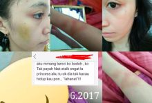 ‘Tak Guna Kenal Bertahun Akhirnya Begini’ – Wanita Cerita Jadi Mangsa Dera Suami Sebaik Kahwin