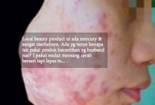 Memang Ada Mercury! – Wanita Ini Dedah Bahaya Local Beauty Product Yang Dipakai Ramai