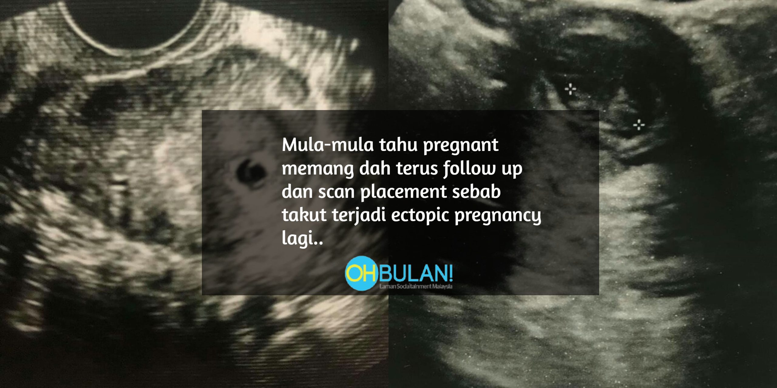 ‘Terima Kasih Sebab Stay Strong Dalam Perut Mami Selama 17 Minggu’ – Wanita Kongsi Kisah Keguguran Sebanyak 5 Kali
