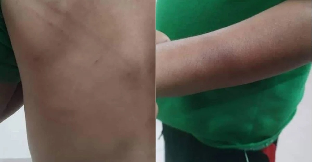 Kanak-Kanak Lelaki Cedera Dirotan