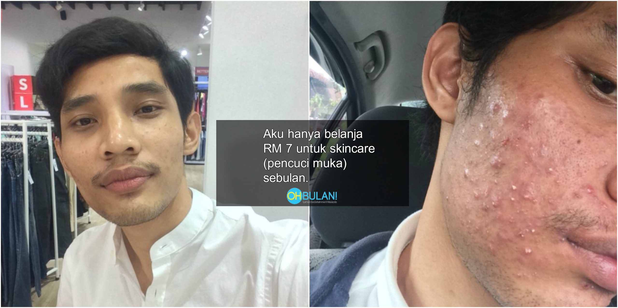 ‘Pernah Gosok Dengan Kertas Pasir’ – Lelaki Ini Kongsi Rahsia Disebalik RM 7 Untuk Kelihatan Flawless
