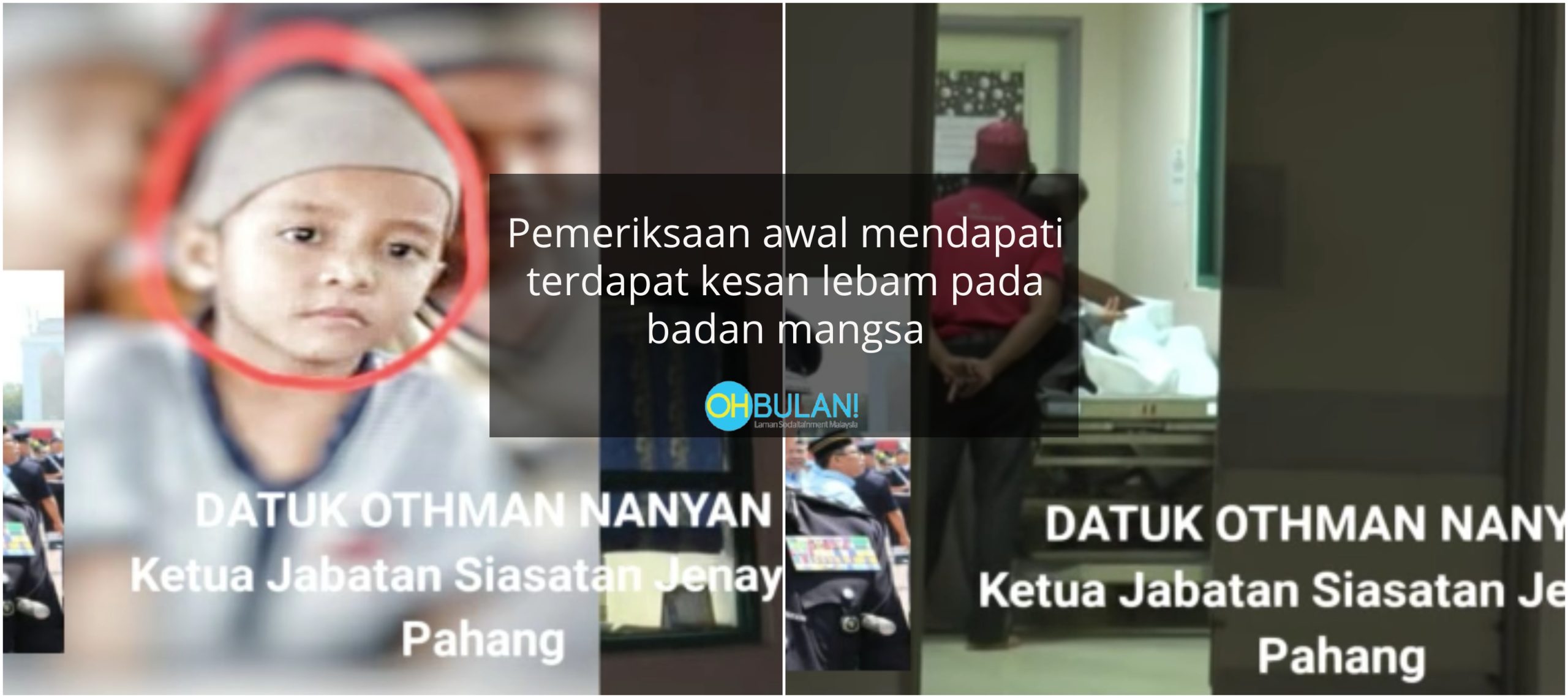 Terdapat Kesan Lebam Di Badan, Pelajar Tahfiz Berusia 7 Tahun Maut Dipukul