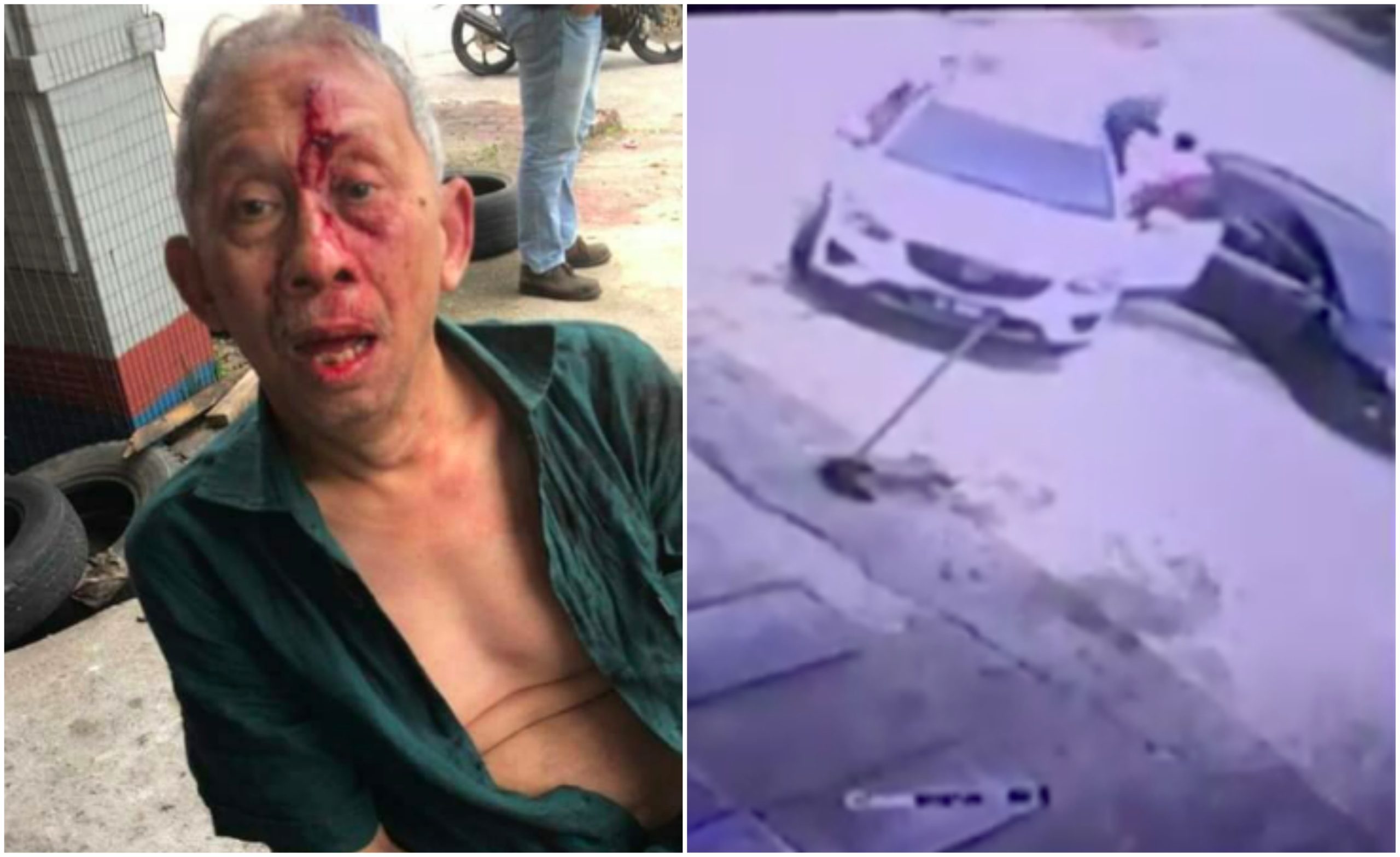 ‘Keadilan Di Akhirat Biarlah Dia Tanggung Sendiri’ – Lunyai Dibelasah Menantu, Mentua Jamin Tuntut Keadilan