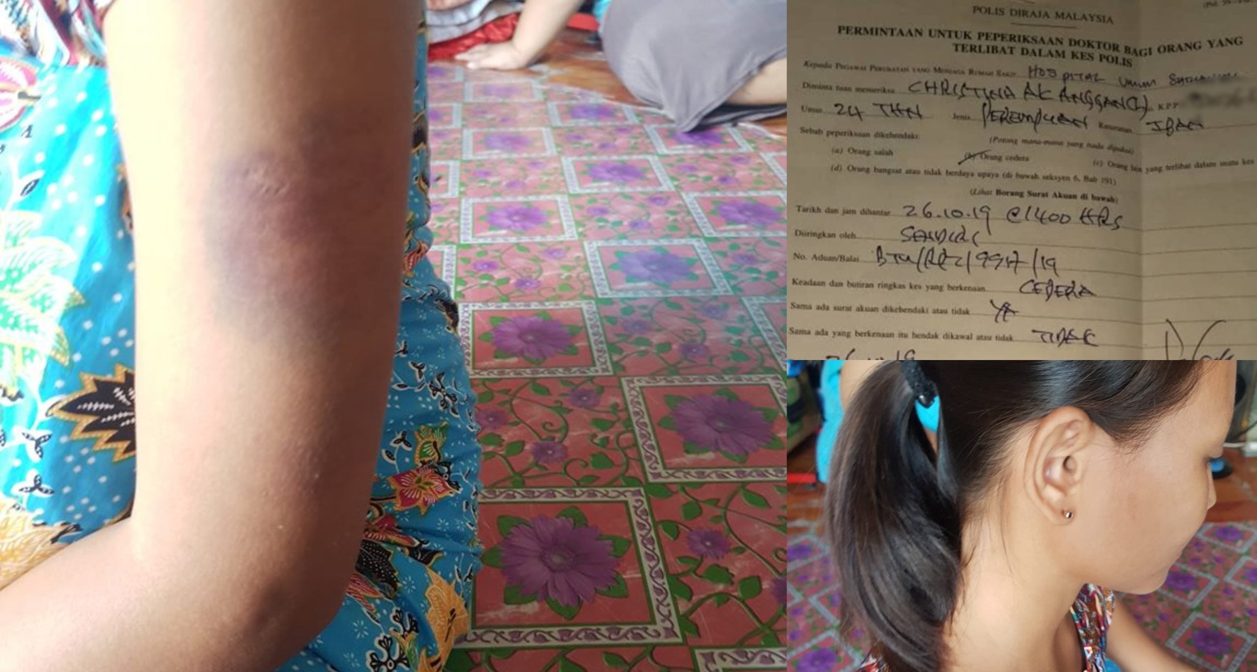Kepala Ditetak Dengan Parang, Isteri Bawa Kandungan 7 Bulan Jalan Kaki Selama 2 Jam Untuk Selamatkan Diri