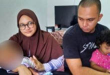 Bilal Yusra Alami Kecacatan Tempurung Kepala Meninggal Dunia