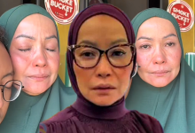 Mak Cik Kemboja Anggap Ujian Yang Menimpa Tanda Allah Sayang – ‘Ramai Doakan Saya’