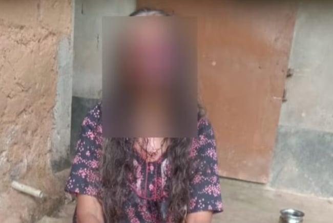 Wanita Cedera Parah Dipukul Suami Mabuk