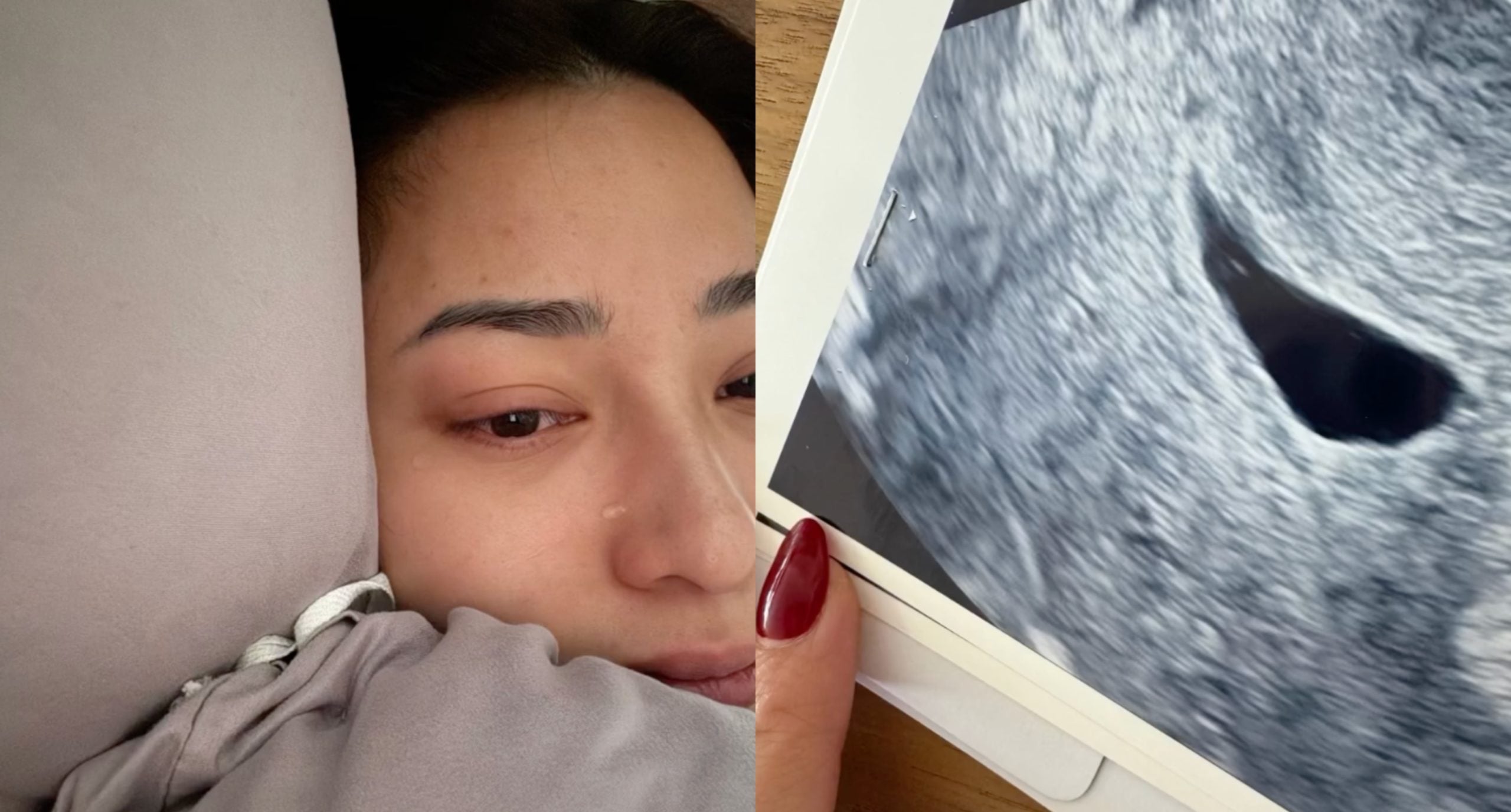 Nikita Willy Sedih, Impian Nak Timang Anak Kedua Tak Kesampaian