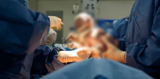 Kepala Bayi Putus, Tertinggal Dalam Rahim Ketika Bersalin -‘Saya Dipaksa Teran, Walaupun Bayi Songsang’