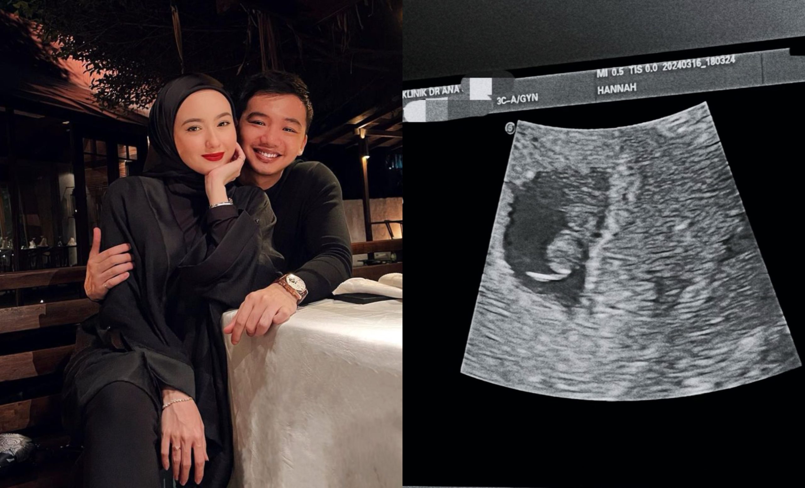 Hannah Delisha Alami Keguguran – ‘Jumpa Di Syurga Nanti Sayang’