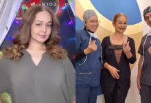 Jasmin Hamid Gembira Berat Badan Turun Hampir 10kg Selepas Sebulan Buat Pembedahan Bariatrik