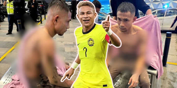 Individu Kongsi Pengalaman Terkena Asid – ‘Bisa Masih Rasa Walau Dah Operation, Saya Dah Setahun Masih Sakit Lagi’