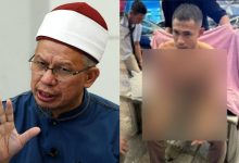 Tidak Berperikemanusiaan & Melampau’ – Dr Zulkifli Tersentak Faisal Halim Disimbah Asid