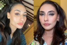 Zarina Anjoulie Amal Diet Sendiri Untuk Kurus, Berat Badan Naik Balik Selepas Rawatan Belon