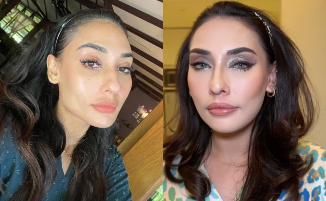 Zarina Anjoulie Amal Diet Sendiri Untuk Kurus, Berat Badan Naik Balik Selepas Rawatan Belon