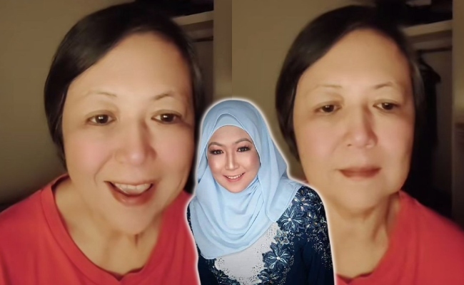 Shima ‘Teringin’ Sudah Tiga Tahun Tak Bertudung – ‘Saya Sensitif Dengan Panas & Sangat Alergik’