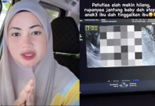 ‘Patutlah Alah Makin Hilang, Rupanya Jantung Baby Dah Stop’ – Kieda Crepe