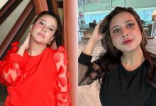 Fathia Latiff Mengaku Suntik ‘Filler’ Demi Nampak Cantik & Muda – ‘Kena Ikut Peredaran Zaman’