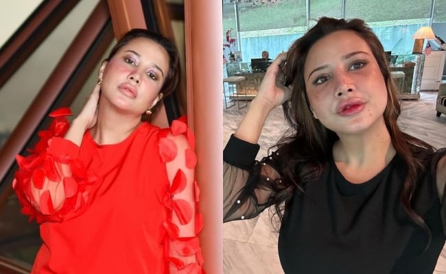 Fathia Latiff Mengaku Suntik ‘Filler’ Demi Nampak Cantik & Muda – ‘Kena Ikut Peredaran Zaman’