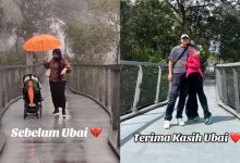 Shila Amzah Kongsi Foto Wajah Lebam, Dedah Trauma Nak Jejak Kaki Ke Pulau Pinang – ‘Terima Kasih Ubai Kerana Selalu Ada’