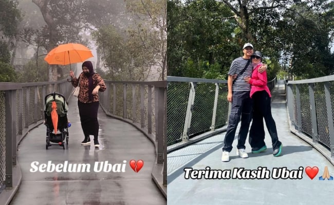 Shila Amzah Kongsi Foto Wajah Lebam, Dedah Trauma Nak Jejak Kaki Ke Pulau Pinang – ‘Terima Kasih Ubai Kerana Selalu Ada’