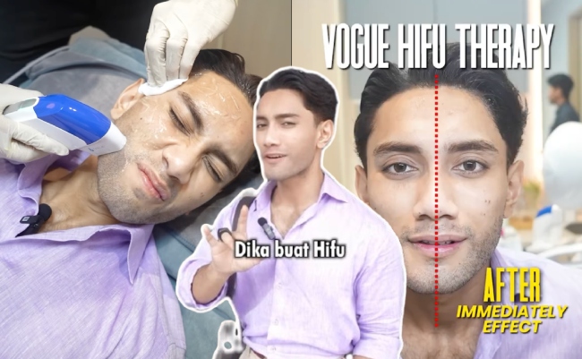 [VIDEO] Muka Makin Terserlah ‘Jawline’, Andika Putera Nafi Ubah Wajah – ‘Tak Ubah, Ini Adalah Treatment’