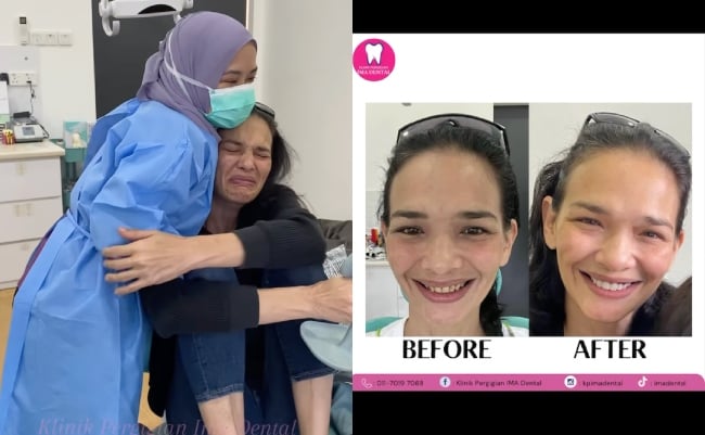 [VIDEO] Zahnita Wilson Tak Dapat Tahan Sebak Dapat ‘Gigi Baharu’ – ‘Lama Sangat Kecantikan Dia Tak Dipelihara’
