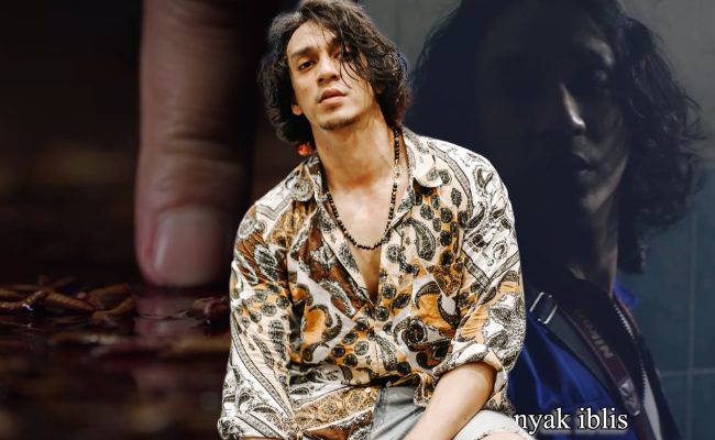 Gara-Gara ‘Dajal’, Jari Tengah Tangan Kiri Amir Nafis Patah