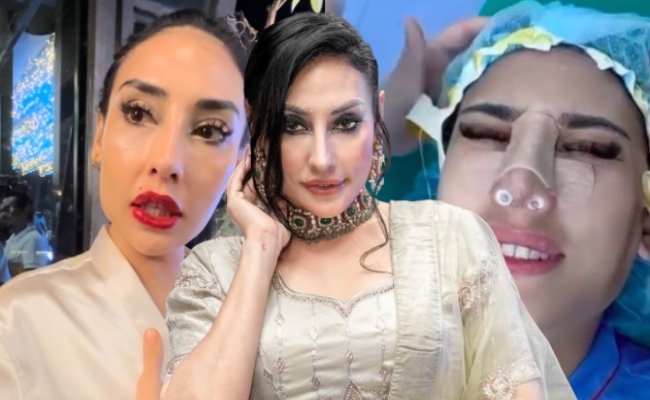 [VIDEO] Zarina Anjoulie Buat Pembedahan Hidung Demi Wang, Nafi Promosi Klinik Di Vietnam – ‘Saya Perlukan Duit Untuk Pembedahan Anak’