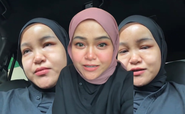 [VIDEO] Aunty Ja Kongsi Wajah Terkini Selepas Kemalangan, Netizen Usik Muka Macam ‘Flower Horn’ – ‘Gelak Berjemaah Pula Tu’