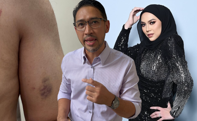 Suami Dakwa Dipukul Zehra Zambri Sebanyak 4 Kali Sepanjang Perkahwinan – ‘Paling Latest Masa Separuh Akhir GV11’