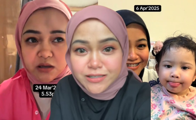 [VIDEO] Auntie Ja Dah Sihat, Tiada Lagi Benjol Di Dahi – ‘Syukur Allah Beri Ujian Ketika Ramadan’